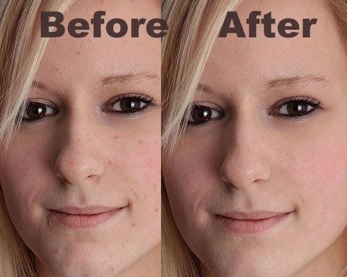 Photoshop-remove-acne in 35 Fantastic Photo Retouching Tutorials